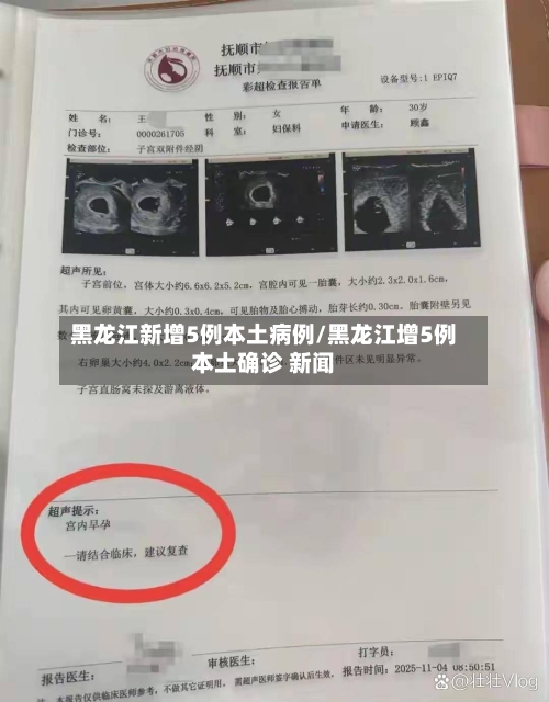 黑龙江新增5例本土病例/黑龙江增5例本土确诊 新闻-第3张图片